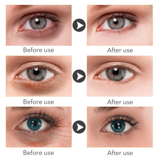 Before and after use comparison of eye product on eyes